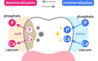 How Dairy Alternatives Prevent Your Tooth Enamel From Repairing?